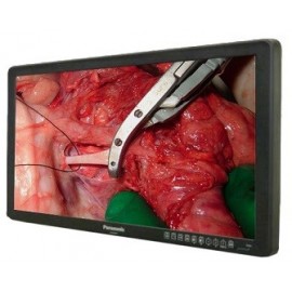 Chirurgische monitoren voor de moderne operatiekamer